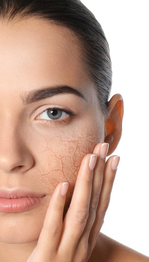 Trockene Haut - Ursachen und Pflege