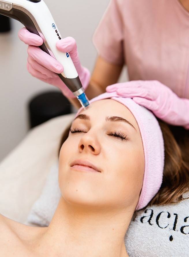 Microneedling Wien