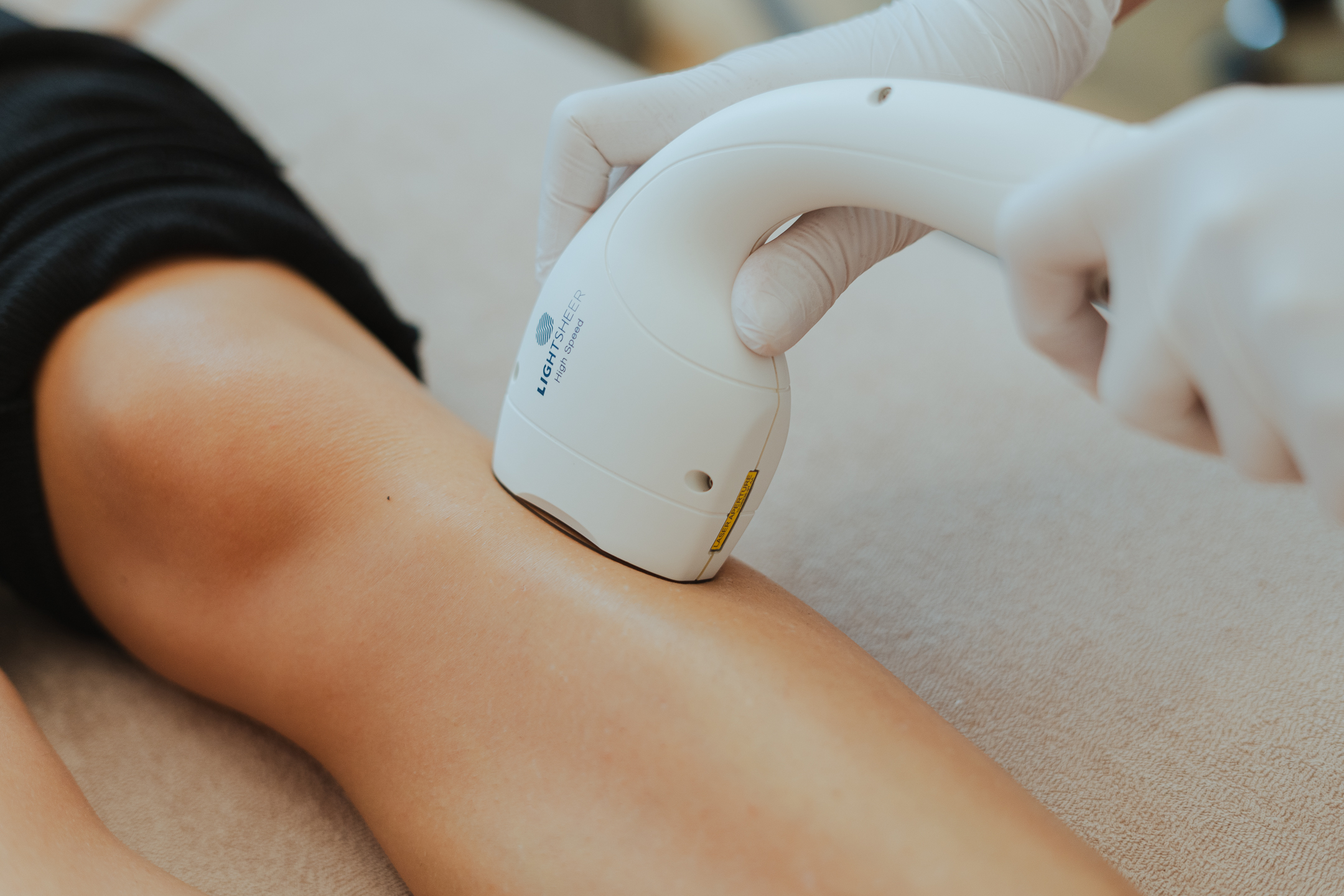 Beine lasern Wien Beine lasern Wien